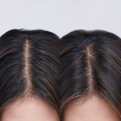 Moroccanoil Masno teme pre i posle Moroccanoil Masno teme pre i posle