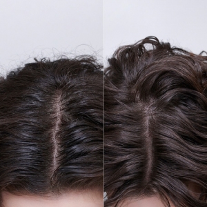 Moroccanoil Oily Scalp Tretman za masno teme Moroccanoil Oily Scalp Tretman za masno teme